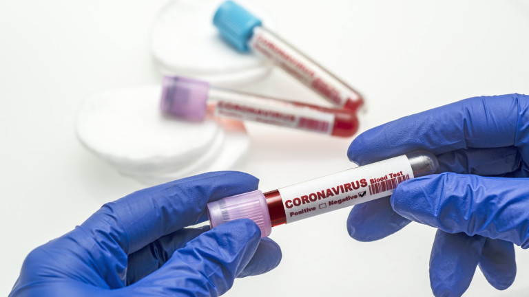 Coronavirus blood test . Coronavirus negative blood in laboratory.