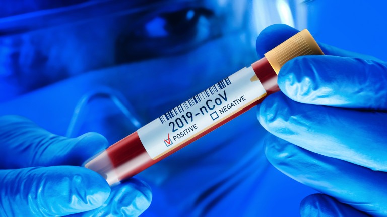 Chinese Coronavirus Blood Test Concept