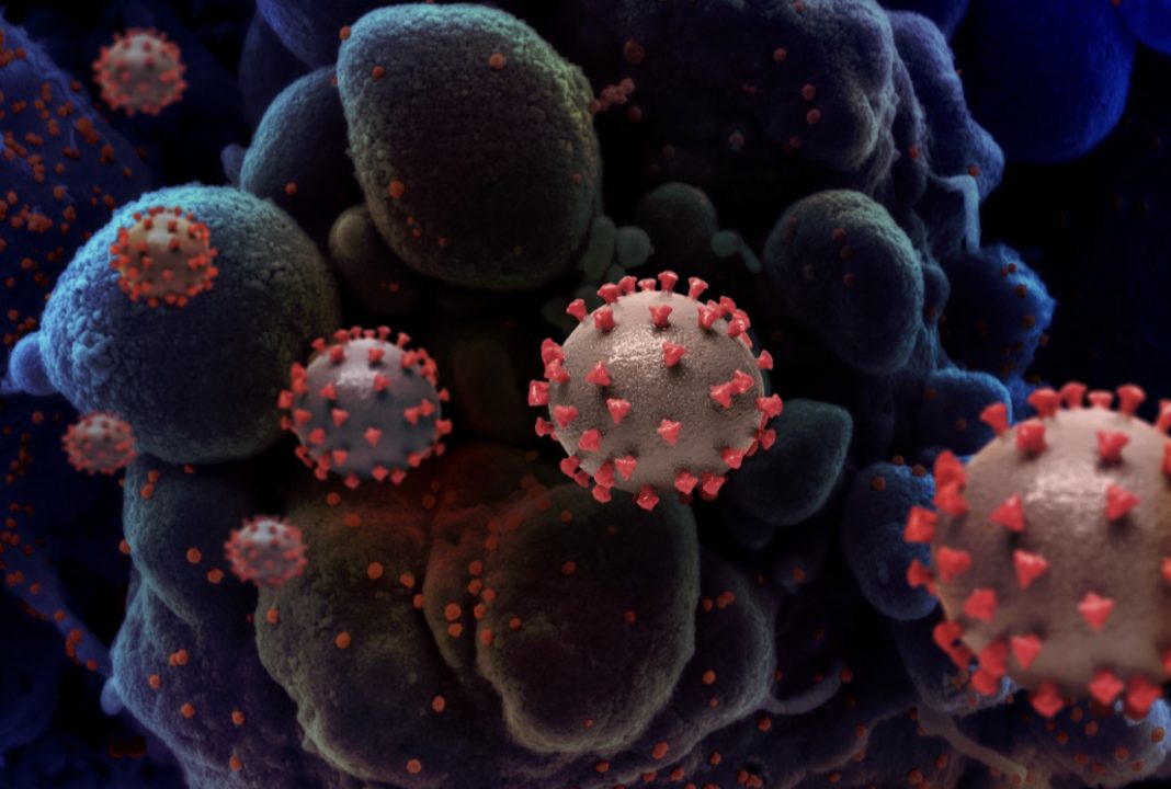 1A69E0CF-CCD3-4603-A04C-E720D7BFF856