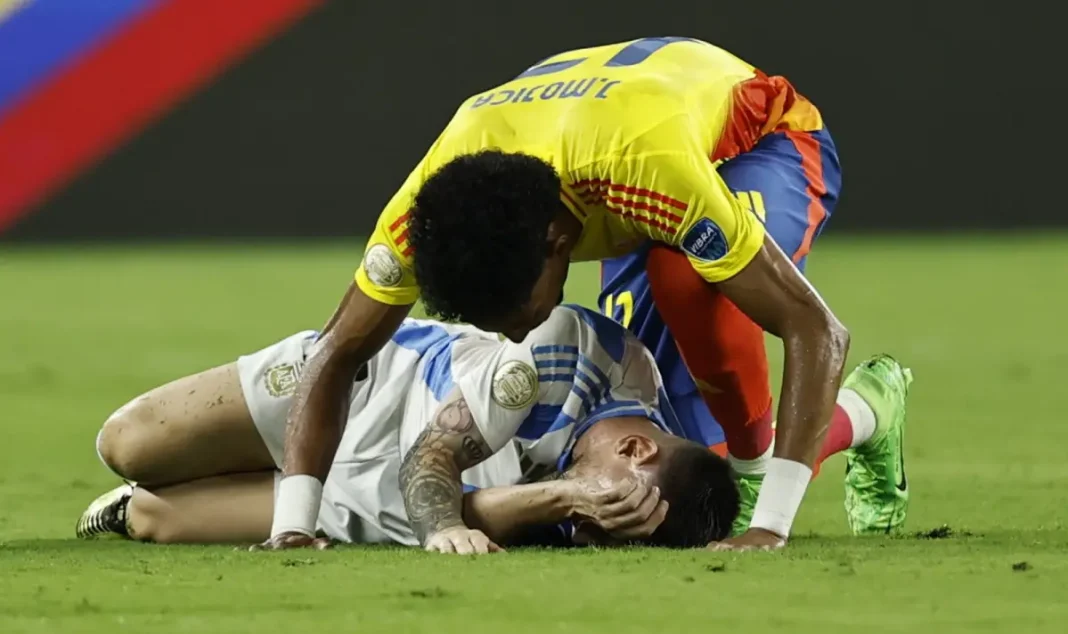 eto-kak-izglejda-kraka-na-mesi-sled-kontuziata-snimka-1