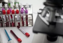 Акциите на Moderna и Merck скочиха рязко след пробив на ваксина срещу меланом